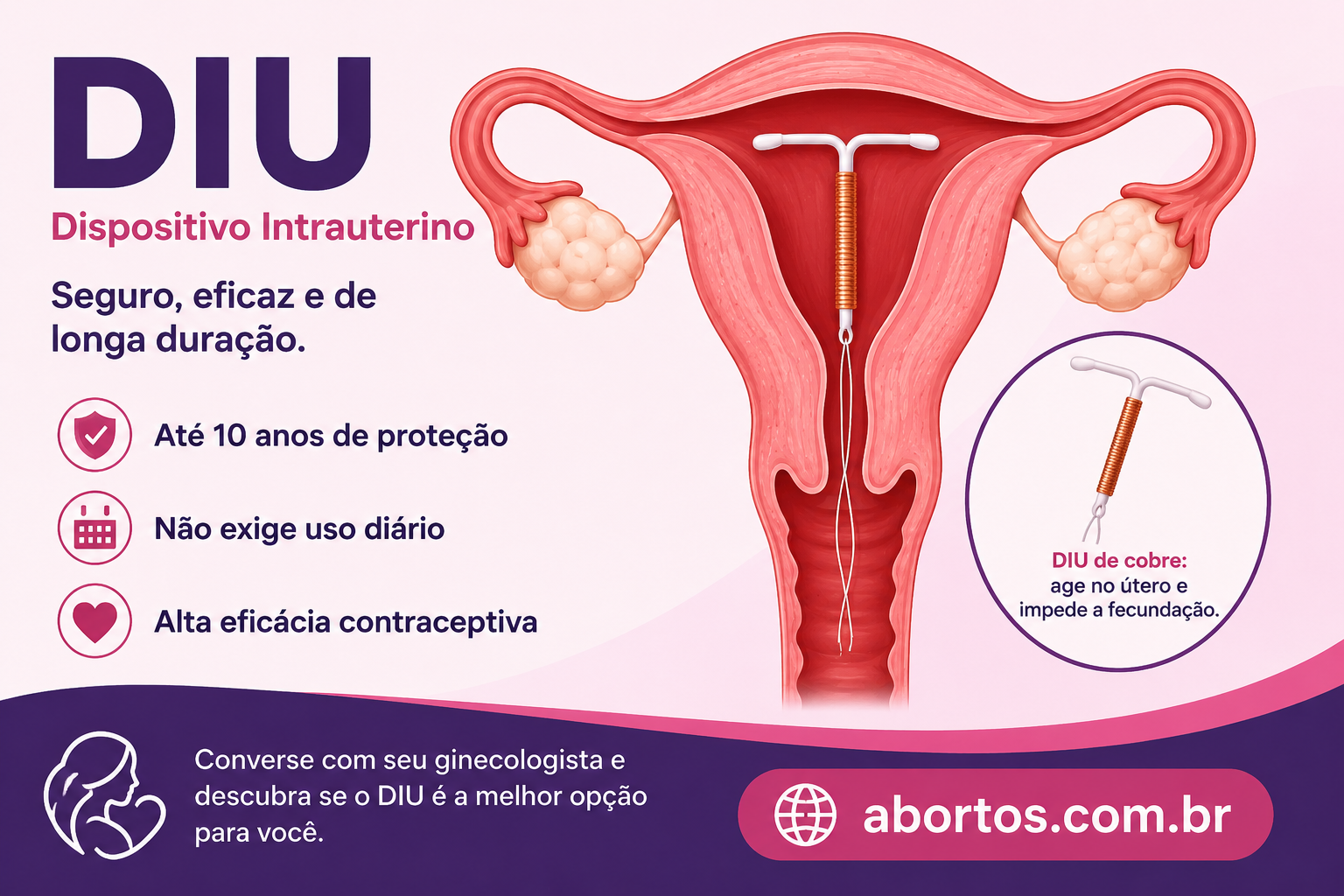 DIU: O Que É, Como Funciona, Vantagens, Eficácia e Contraindicações