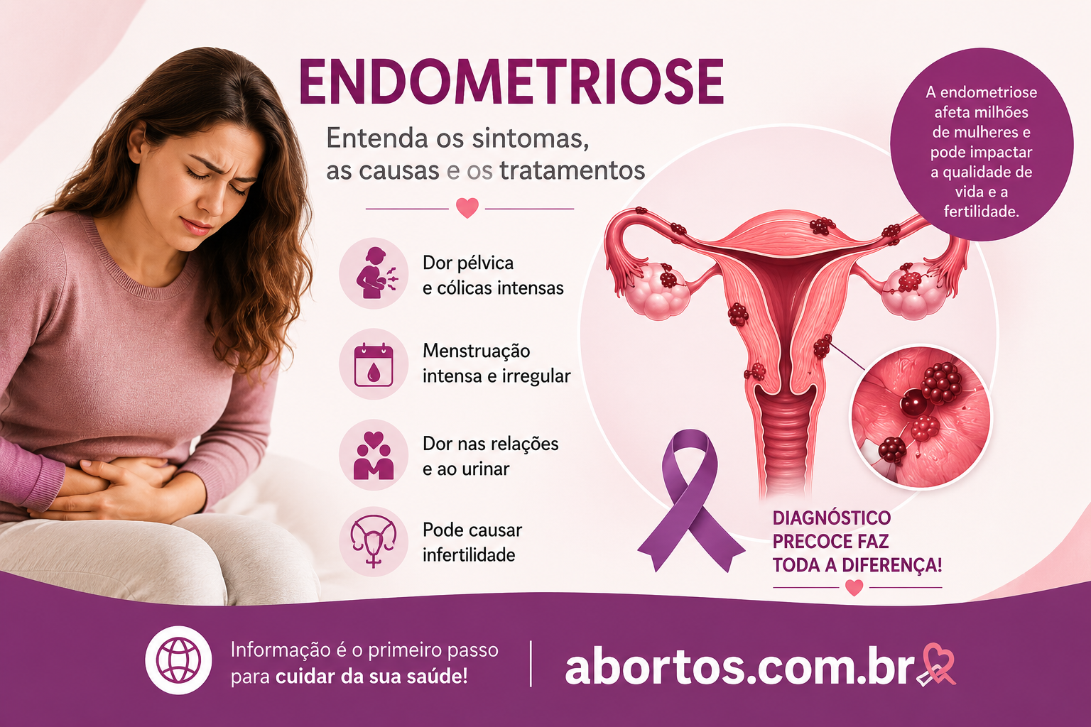 Endometriose: Sintomas, Causas, Diagnóstico e Tratamentos Atualizados