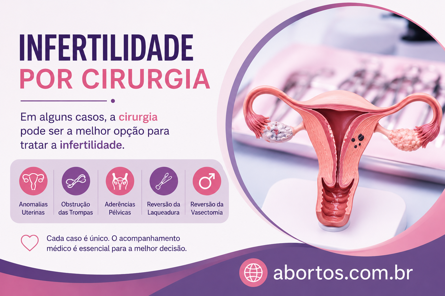 Infertilidade por Cirurgia: Quando a Cirurgia Pode Ajudar na Fertilidade